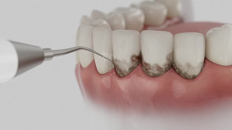Reliable Invisalign Clear Aligners contractor in Craig County County, VA by Dentist Open Now